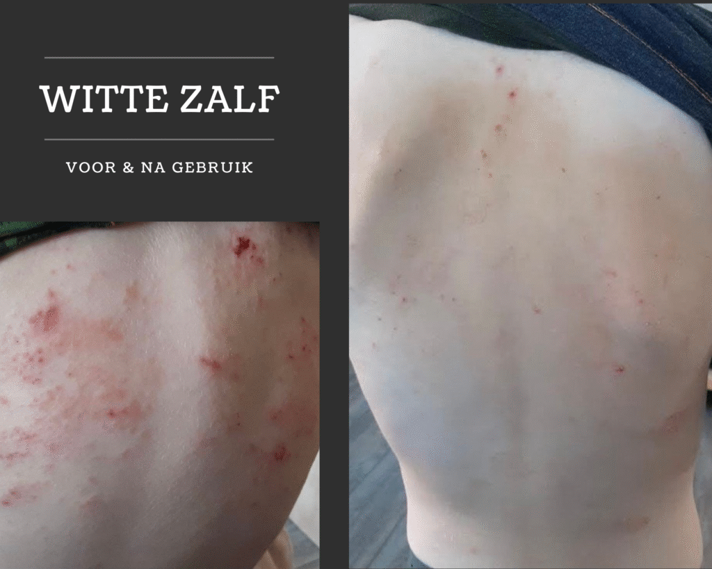 Witte Zalf voor dag 8 dag 11