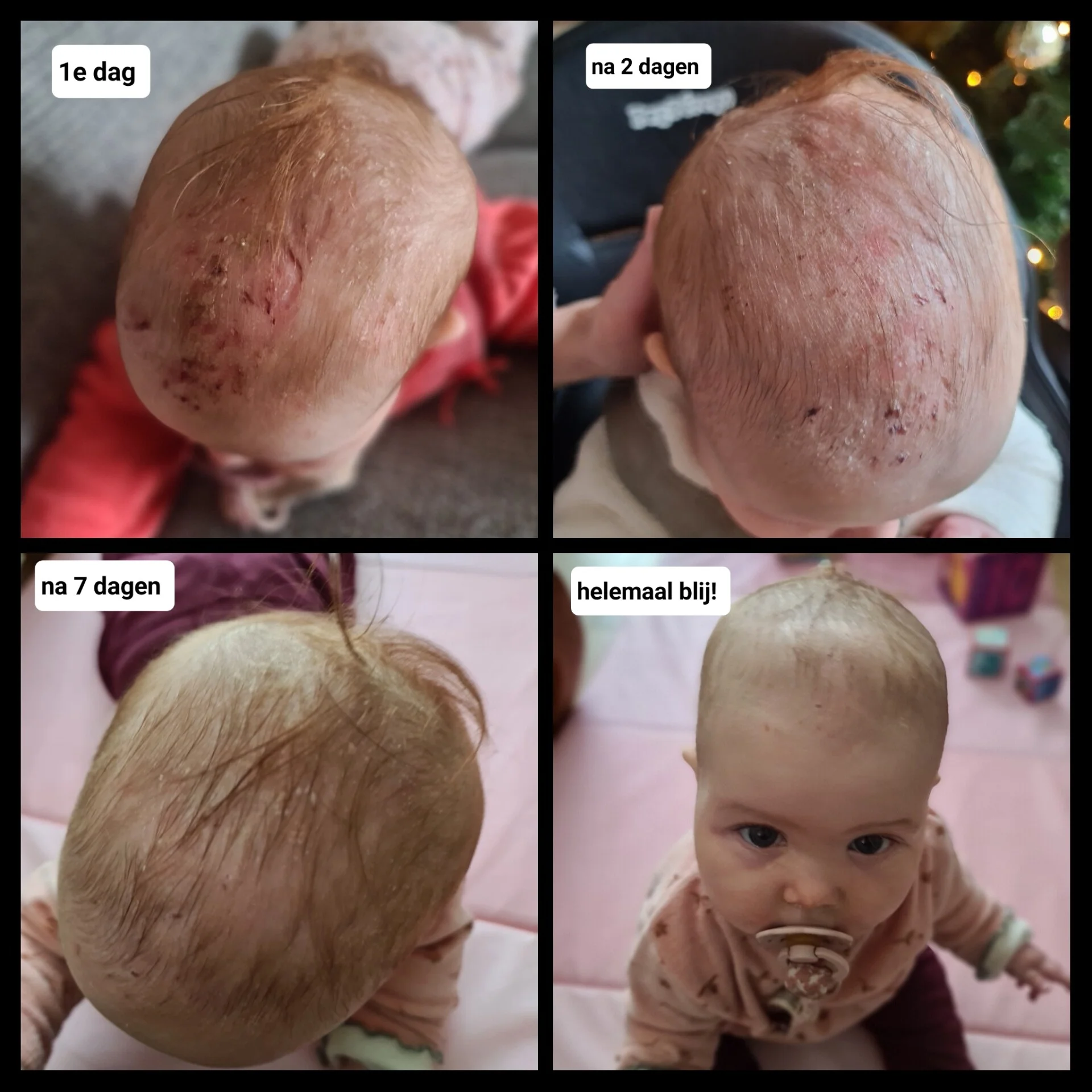 wittezalffotocollage